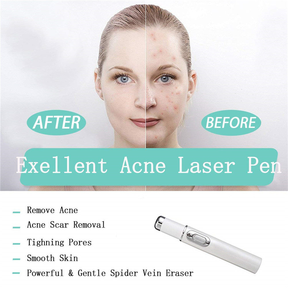 Blue Light Therapy Acne Laser Pen Facial Massager Treatment Soft Scar Wrinkle Acne Removal Device